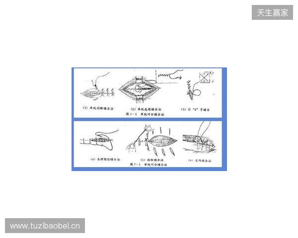 广州豹官方:杨浩眉弓伤口缝合30余针,预计5-7天后拆线 广州豹官方:杨浩眉弓伤口缝合30余针,预计5-7天后拆线